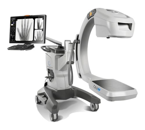 Orthoscan TAU Orthoscan TAU